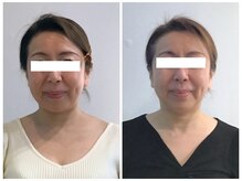 シンメトリー 麻布十番/Before/After