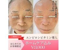 サラシック(salachic)