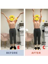 レピア 夙川本店(Lepia)/ビフォーアフターのご紹介♪