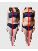 エデン アンジュ(EDEN ange)/姿勢改善・アライメント修正に