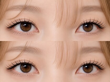 アイミーアイビューティー 宇都宮本店(ime eye beauty)の写真
