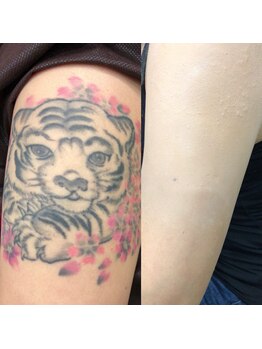 ドール (Doll)/ボディーメイク