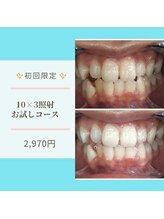 ライトビューティー 本八幡店(LIGHT BEAUTY)/