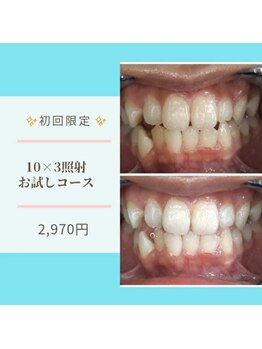 ライトビューティー 本八幡店(LIGHT BEAUTY)/