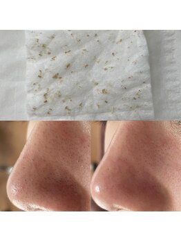 クレビア(CREVIA)/二刀流エクストラクション