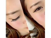 スノア(SUNOA)/マツエク