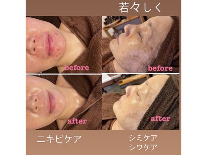 エヌエースキン(NAskin)の写真