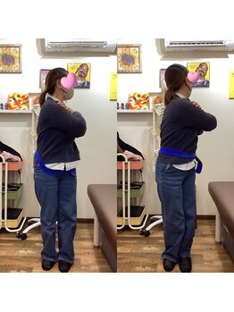 ヒデ整体院(Hide整体院)/猫背矯正骨盤矯正B/A肩こり腰痛