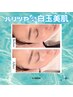 【肌悩み別選べる美容液◎】ヒト幹導入♪ハイドロ×プラズマシャワー　¥13000