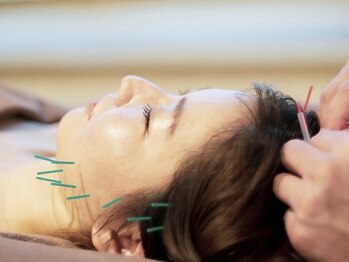 御徒町よつば整骨院/美容鍼