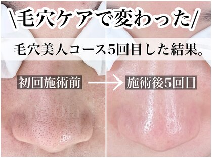 ニュートラル(neutral)の写真