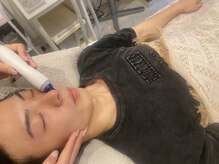 アカヌケ(AKANUKE)