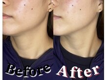 小顔東京 関内店