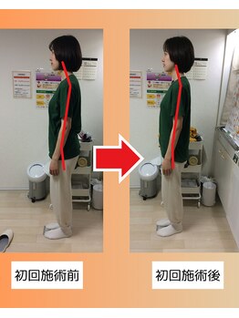 ストラボ 横浜店/ビフォーアフター３