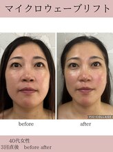 サロンドココ(Salon de COCO)/マイクロウェーブリフト