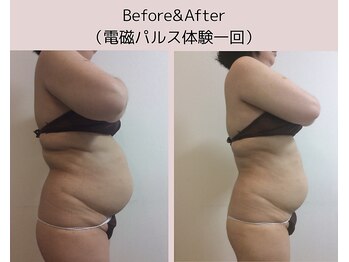 Hb 与野/ぽっこりお腹変化