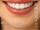 ラフ(LAUGH)の写真