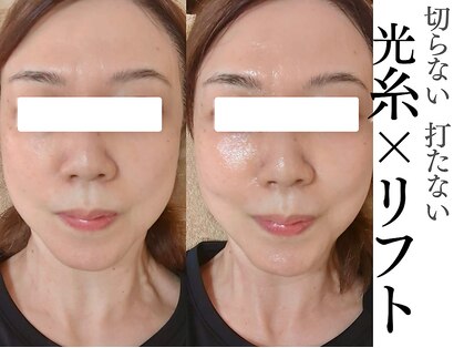 ボディメイキング キキ(Bodymaking KIKI)の写真