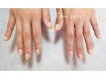 シュポルテ(chou porte)/ナチュラルゴールドラメ