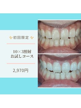 ライトビューティー 本八幡店(LIGHT BEAUTY)/体験30分で目に見える効果!