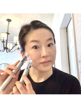 シベル(Si Belles)/10年後、自信が持てるお顔に