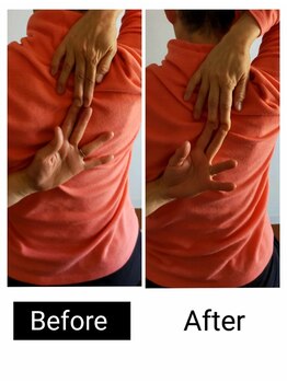 アース エンジェル整体院/ビフォアフ 肩甲骨はがし