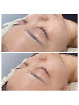 セントラッシュ 島田店(St.Lush)/艶肌wax