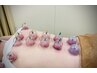 ≪血行促進で健康改善≫整体＋吸玉コース 50分