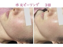 ビューティースパ/くすみ/毛穴が目立たなく/ツヤ肌