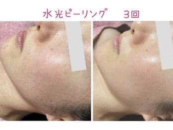 ビューティースパ/くすみ/毛穴が目立たなく/ツヤ肌