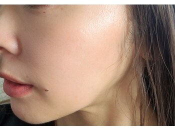 エスボーテ(sbeaute)/プラズマ+ダクトピール