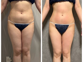 フュース(Futh)/全身サイズダウン/ダイエット