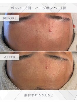 モネ オキナワ(MONE okinawa.)/洗顔後もトーンUP