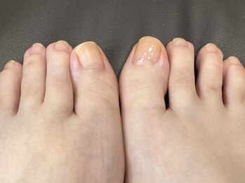 リフト(Re:ft)の写真/足元から美しく…。後回しにしがちなお足元だからこそフットケア専門店へ♪【角質・ネイル・フットバス】