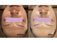 アロマジャムゥ 庚午店/ララピール成分