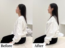 ソレア(Solea)/首肩こり・巻き肩改善1回目