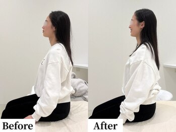 ソレア(Solea)/首肩こり・巻き肩改善1回目