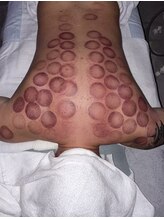 中国整体 らくらく堂/経絡・ツボマッサージ温熱療法