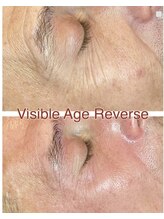 ティーボックスボーテ(TBOX beaute)/