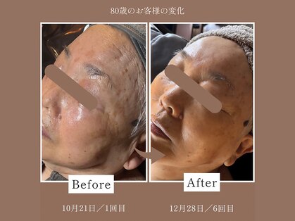 フェイシャル・エイジングケア専門店 Well-Aging Salon Panselinos【パンセリーノ】の写真