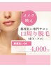 【メイクノリUP】(鼻下・あご)口周り脱毛 ¥4,000|都度払いOK※女性専用