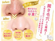 ルイスラグジュアリー(LOUIS LUXURY)の雰囲気(《開き毛穴は今日で卒業◎》鼻・頬の開き毛穴専用毛穴吸引¥9980)