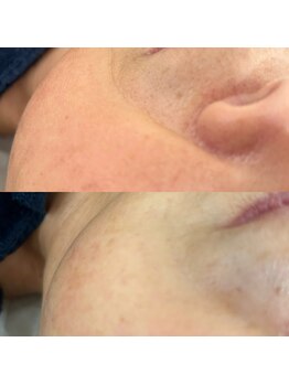 エムズ(M’s)/フォト　ビフォーアフター