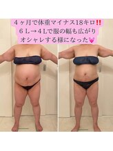 ソエルテ(soerute)/最新キャビテーション