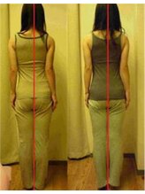 里の整体 京都/数回の通院で歪みも体型も改善2