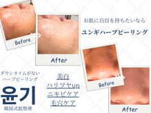 アール(R)の雰囲気（色々な肌悩みに寄り添うフェイシャルエステ♪）