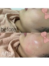 シュシュ(Chou Chou)/