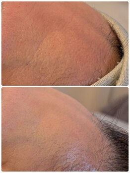 グリーナリー エスト(Greenery est)/ダクトピール×プラズマ光