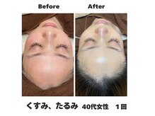 ラナン パラフューズ(Ranun's PARAFUSE.)/透明感UP♪褒められ肌へ☆