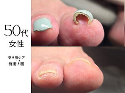 フットケア クラッシー(footcare classy)の写真